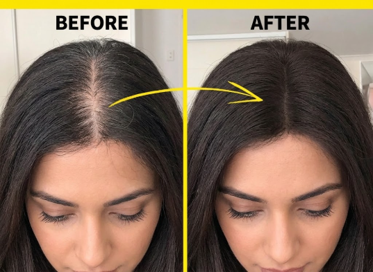 Before and after showing dark root and part coverage